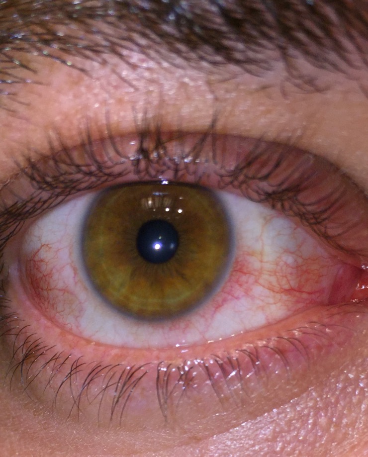 IMG_1781.PNG